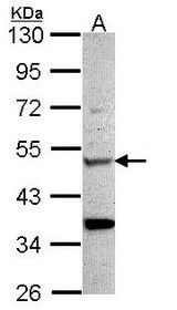 Sample (30 ug of whole cell lysate). A: Hela. 10% SDS PAGE. CHIT1 / Chitotriosidase antibody diluted at 1:1000.
