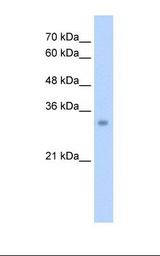 HepG2 cell lysate. Antibody concentration: 2.5 ug/ml. Gel concentration: 12%.