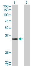 Western Blot analysis of ECH1 expression in transfected 293T cell line by ECH1 monoclonal antibody (M01), clone 5G8.Lane 1: ECH1 transfected lysate(35.8 KDa).Lane 2: Non-transfected lysate.
