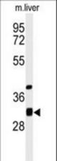 Western blot of ECHDC1 Antibody in mouse liver tissue lysates (35 ug/lane). ECHDC1 (arrow) was detected using the purified antibody.
