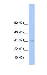 MCF7 cell lysate. Antibody concentration: 1.0 ug/ml. Gel concentration: 10-20%.