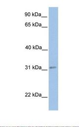 721_B cell lysate. Antibody concentration: 1.0 ug/ml. Gel concentration: 12%.