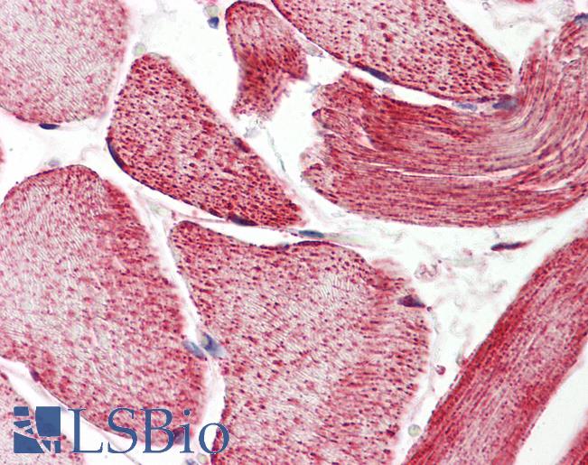 Anti-ECI2 antibody IHC of human skeletal muscle. Immunohistochemistry of formalin-fixed, paraffin-embedded tissue after heat-induced antigen retrieval. Antibody LS-B8576 dilution 5 ug/ml.