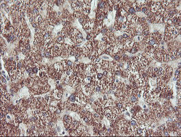 IHC of paraffin-embedded Human liver tissue using anti-PECI mouse monoclonal antibody. (Heat-induced epitope retrieval by 10mM citric buffer, pH6.0, 100C for 10min).
