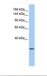 Fetal liver lysate. Antibody concentration: 1.0 ug/ml. Gel concentration: 6-18%.