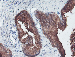 IHC of paraffin-embedded Human prostate tissue using anti-PECI mouse monoclonal antibody. (Heat-induced epitope retrieval by 10mM citric buffer, pH6.0, 100C for 10min).