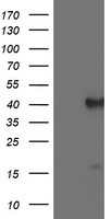 HEK293T cells were transfected with the pCMV6-ENTRY control (Left lane) or pCMV6-ENTRY PECI (Right lane) cDNA for 48 hrs and lysed. Equivalent amounts of cell lysates (5 ug per lane) were separated by SDS-PAGE and immunoblotted with anti-PECI.