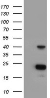 HEK293T cells were transfected with the pCMV6-ENTRY control (Left lane) or pCMV6-ENTRY PECI (Right lane) cDNA for 48 hrs and lysed. Equivalent amounts of cell lysates (5 ug per lane) were separated by SDS-PAGE and immunoblotted with anti-PECI.