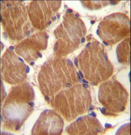 ASAM Antibody immunohistochemistry of formalin-fixed and paraffin-embedded human skeletal muscle followed by peroxidase-conjugated secondary antibody and DAB staining.