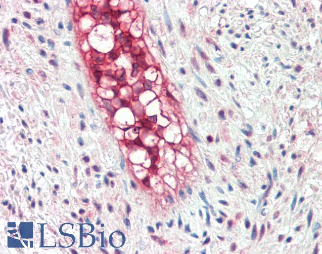 Anti-ECSCR antibody IHC staining of human vessel. Immunohistochemistry of formalin-fixed, paraffin-embedded tissue after heat-induced antigen retrieval. Antibody LS-B10278 concentration 5 ug/ml.