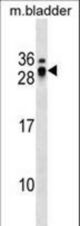 ECSCR Antibody western blot of mouse bladder tissue lysates (35 ug/lane). The ECSCR antibody detected the ECSCR protein (arrow).