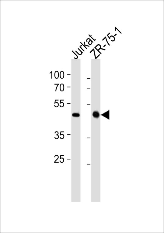 ECSIT Antibody western blot of Jurkat,ZR-75-1 cell line lysates (35 ug/lane). The ECSIT antibody detected the ECSIT protein (arrow).