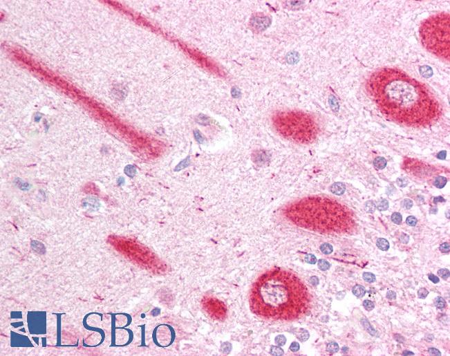 Anti-ECSIT antibody IHC of human brain, cerebellum. Immunohistochemistry of formalin-fixed, paraffin-embedded tissue after heat-induced antigen retrieval. Antibody LS-B1351 concentration 5 ug/ml.