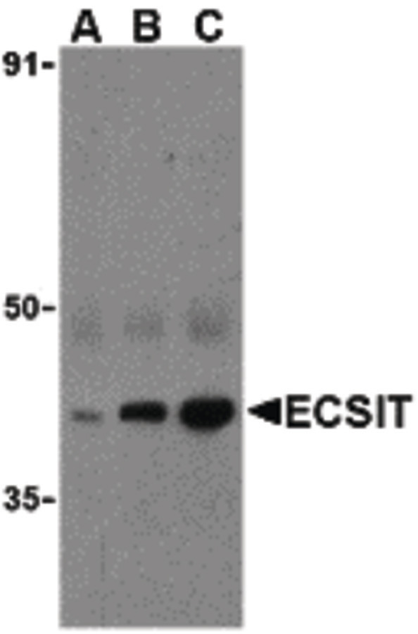 Western blot of ECSIT in human heart cell lysates with ECSIT antibody at (A) 0.5, (B) 1, and (C) 2 ug/ml.