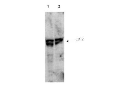 Anti-ECT2 pT790 Antibody - Western Blot. Western blot of affinity purified anti-ECT2 pT790 antibody shows detection of endogenous phosphorylated ECT2 (arrowhead) present in cell lysates from interphase (lane 1) and mitotic (lane 2) HeLa cells. Despite specific staining of interphase cells, this reagent is believed to be phospho specific based on ELISA results using both phosphorylated and non-phosphorylated immunizing peptide. After SDS-PAGE and transfer, the membrane was probed with the primary antibody diluted to 1:1000. Personal Communication, Toru Miki, CCR-NCI, Bethesda, MD.