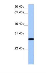 Hela cell lysate. Antibody concentration: 1.0 ug/ml. Gel concentration: 12%.