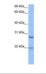 HepG2 cell lysate. Antibody concentration: 1.0 ug/ml. Gel concentration: 12%.