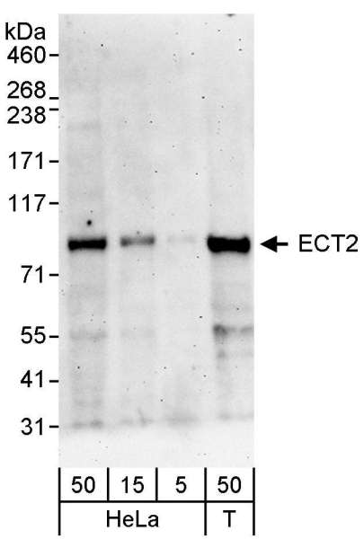 Detection of Human ECT2 by Western Blot. Samples: Whole cell lysate (5, 15 and 50 ug) from HeLa and 293T (T; 50 ug) cells. Antibody: Affinity purified rabbit anti-ECT2 antibody used for WB at 0.1 ug/ml. Detection: Chemiluminescence with an exposure time of 3 minutes.