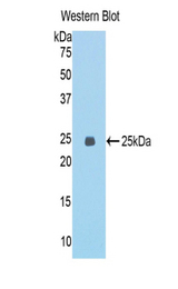 Western blot of recombinant ECT2.