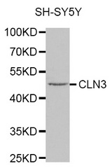 Western blot analysis of extracts of SH-SY5Y cell line, using CLN3 antibody.