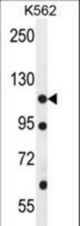 ECT2L Antibody western blot of K562 cell line lysates (35 ug/lane). The ECT2L antibody detected the ECT2L protein (arrow).