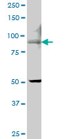 TRPV5 monoclonal antibody (M06), clone 6D6. Western blot of TRPV5 expression in IMR-32.