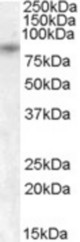 Antibody (1 ug/ml) staining of Human Pancreas lysate (35 ug protein in RIPA buffer). Primary incubation was 1 hour. Detected by chemiluminescence.