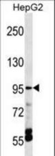 TRPV5 Antibody western blot of HepG2 cell line lysates (35 ug/lane). The TRPV5 antibody detected the TRPV5 protein (arrow).