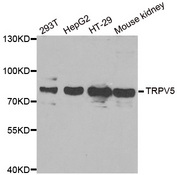 Western blot analysis of extracts of various cell lines, using TRPV5 antibody.
