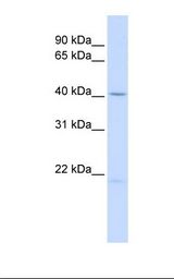 721_B cell lysate. Antibody concentration: 1.0 ug/ml. Gel concentration: 12%.