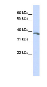 EDA antibody LS-C102110 Western blot of HepG2 cell lysate.