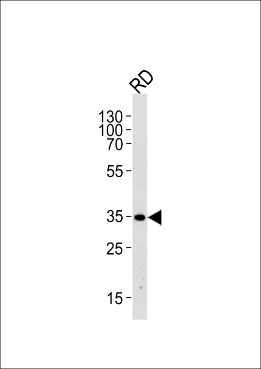 Western blot of lysate from RD cell line,using EDA Antibody. Antibody was diluted at 1:1000 at each lane. A goat anti-rabbit IgG H&L (HRP) at 1:5000 dilution was used as the secondary antibody.Lysate at 35ug per lane.