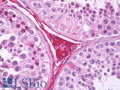 Anti-EDA2R antibody IHC of human testis, Leydig cells. Immunohistochemistry of formalin-fixed, paraffin-embedded tissue after heat-induced antigen retrieval. Antibody LS-B7278 concentration 2.5 ug/ml.