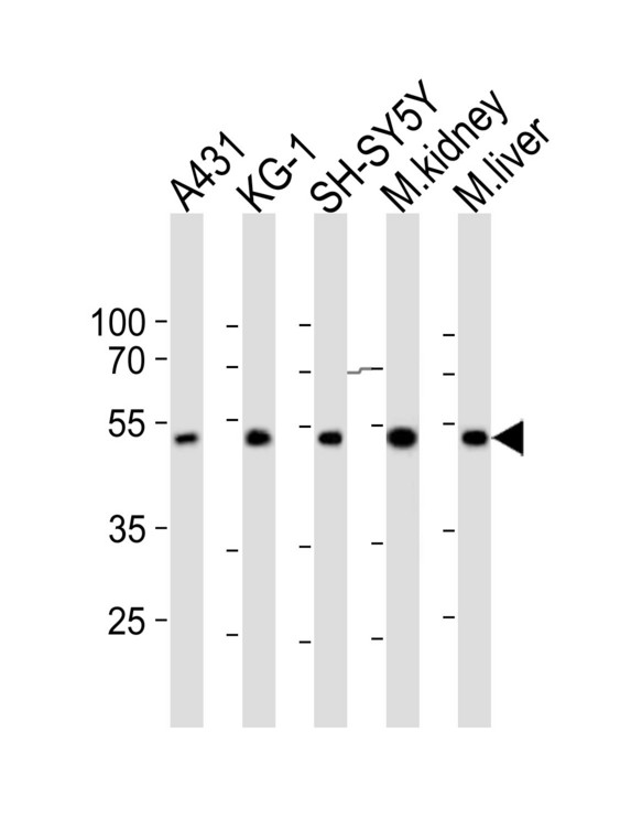 Western blot of lysates from A431, KG-1, SH-SY5Y cell line, mouse kidney, mouse liver tissue (from left to right) with CLN3 Antibody. Antibody was diluted at 1:1000 at each lane. A goat anti-rabbit IgG H&L (HRP) at 1:10000 dilution was used as the secondary antibody. Lysates at 20 ug per lane.