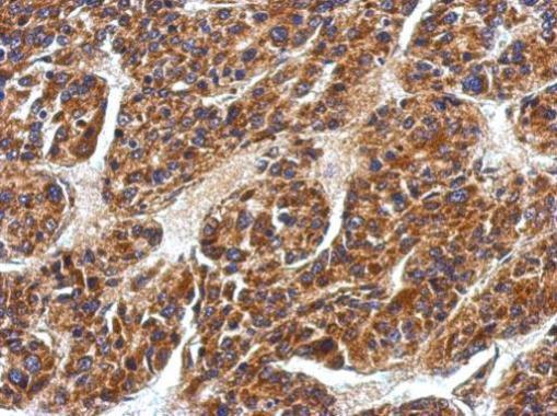 Anti-EDAR antibody used in IHC (Formalin-fixed paraffin-embedded sections).