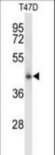 Western blot of CLN5 Antibody in T47D cell line lysates (35 ug/lane). CLN5 (arrow) was detected using the purified antibody.
