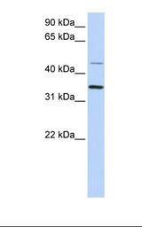 293T cell lysate. Antibody concentration: 1.0 ug/ml. Gel concentration: 12%.
