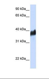 293T cell lysate. Antibody concentration: 1.0 ug/ml. Gel concentration: 12%.