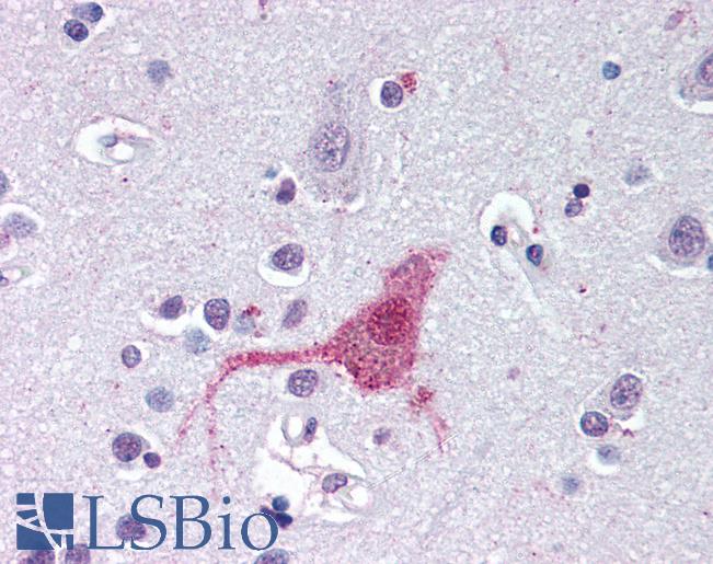 Anti-EDNRB antibody LS-A55 IHC of human brain, cortex. Immunohistochemistry of formalin-fixed, paraffin-embedded tissue after heat-induced antigen retrieval.