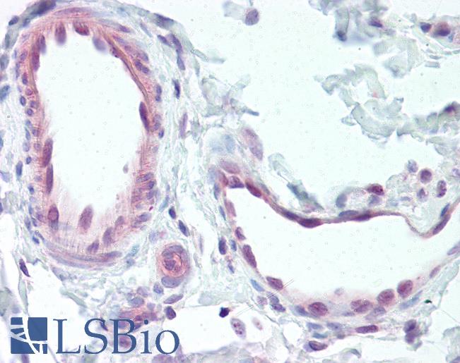 Anti-EDNRB antibody LS-A57 IHC of human vessels. Immunohistochemistry of formalin-fixed, paraffin-embedded tissue after heat-induced antigen retrieval.