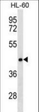 CLN8 Antibody western blot of HL-60 cell line lysates (35 ug/lane). The CLN8 antibody detected the CLN8 protein (arrow).