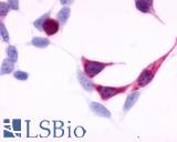 Anti-EDNRB antibody LS-A54 immunocytochemistry (ICC) staining of HEK293 human embryonic kidney cells transfected with EDNRB.