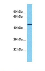 Western blot of Human Thyroid Tumor. PEG10 antibody dilution 1.0 ug/ml.