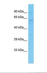 Western blot of Human Lung Tumor. PEG10 antibody dilution 1.0 ug/ml.