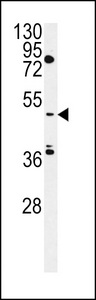 MIST Antibody western blot of HepG2 cell line lysates (35 ug/lane). The MIST antibody detected the MIST protein (arrow).