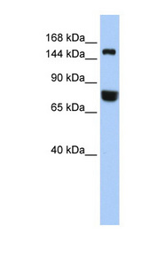 EEA1 antibody LS-C112159 Western blot of 721_B cell lysate.