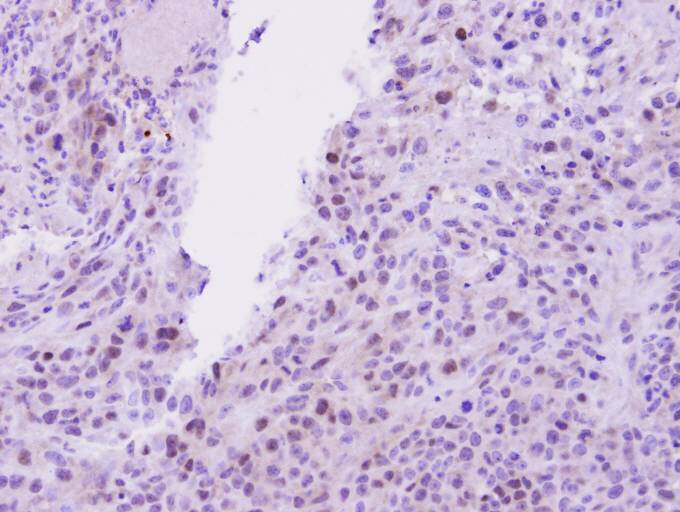 IHC of paraffin-embedded SAS Xenograft using EED antibody at 1:100 dilution.