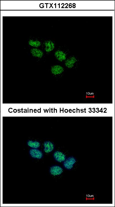 Immunofluorescence of paraformaldehyde-fixed A431 using EED antibody at 1:500 dilution.