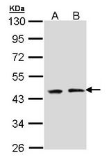 Sample (30 ug of whole cell lysate). A: A431 , B: H1299. 10% SDS PAGE. EED antibody diluted at 1:1000.