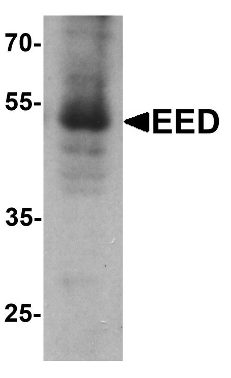 Western blot analysis of EED in human heart tissue lysate with Eed antibody at 1 ug/ml.